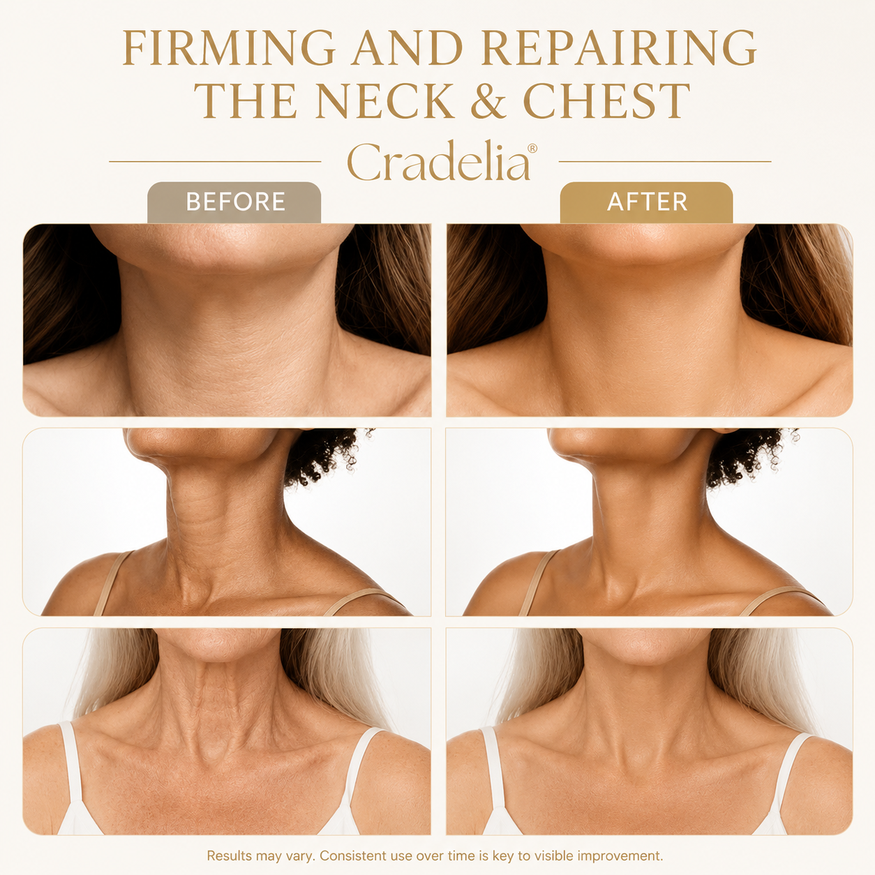 Neck Firming Cream with Roller Applicator – Collagen & Niacinamide for Wrinkles, Crepey Skin & Jawline Tightening