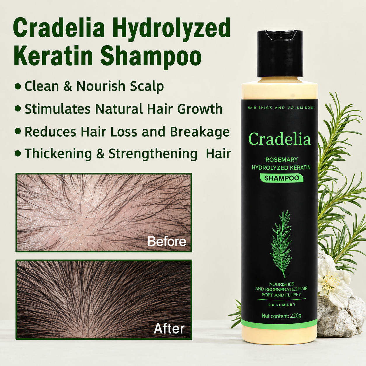 Hair Growth Shampoo for Thinning Hair – Rosemary Oil Anti Hair Loss Thickening Shampoo with Hydrolyzed Keratin, Biotin & Aloe Vera