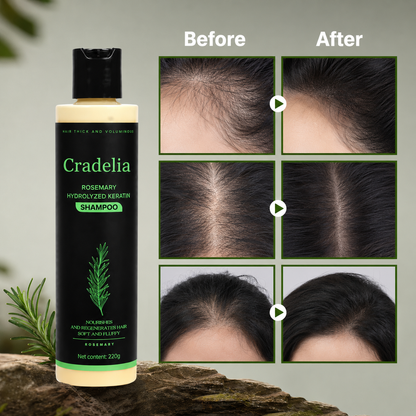 Rosemary Shampoo for Hair Growth – Rosemary Oil Thickening Shampoo for Thinning Hair, Hair Loss, Shedding & Stronger Fuller Hair