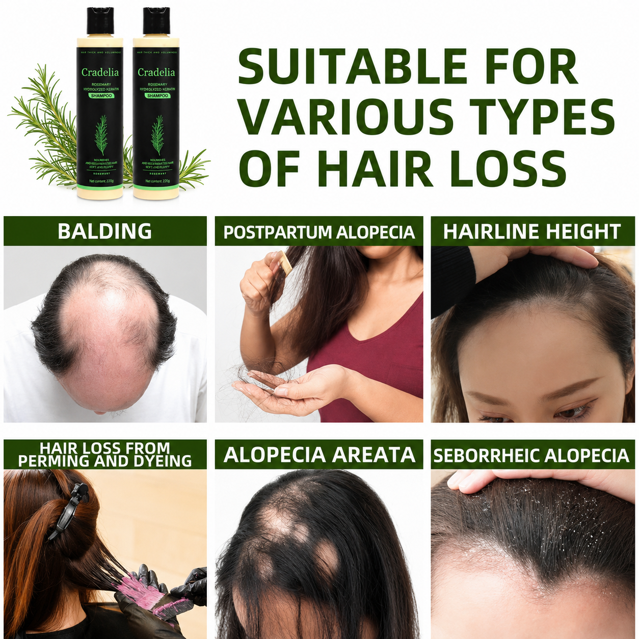 Hair Growth Shampoo for Thinning Hair – Rosemary Oil Anti Hair Loss Thickening Shampoo with Hydrolyzed Keratin, Biotin & Aloe Vera