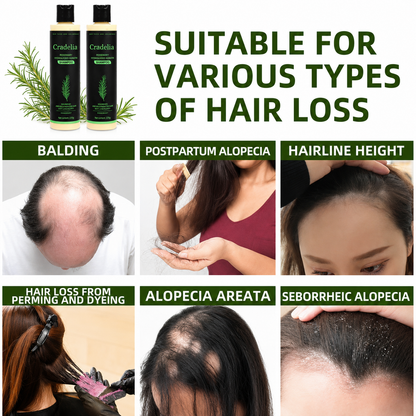 Hair Growth Shampoo for Thinning Hair – Rosemary Oil Anti Hair Loss Thickening Shampoo with Hydrolyzed Keratin, Biotin & Aloe Vera