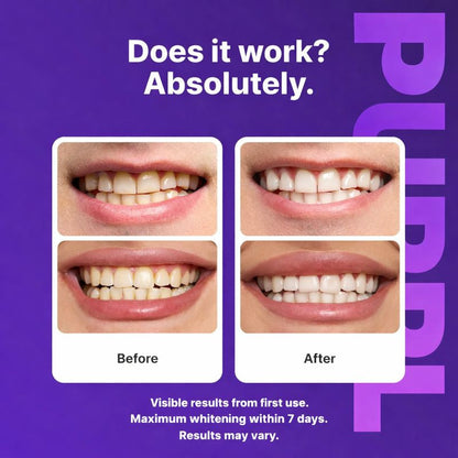 Color Correcting Whitening Strips