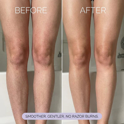 Hair Removal Cream for Women & Men | Painless Hair Removal Mousse for Sensitive Skin