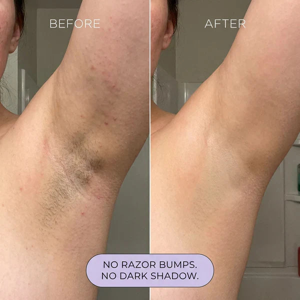 Bikini Hair Removal Cream for Sensitive Skin | Gentle Body Hair Removal Mousse