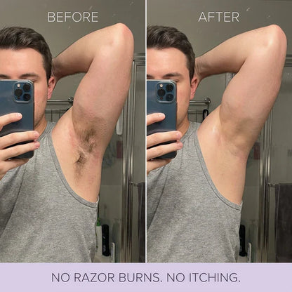 Bikini Hair Removal Cream for Sensitive Skin | Gentle Body Hair Removal Mousse