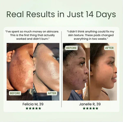 Exfoliating Toner Pads for Texture & Blemishes | Korean Face Pads for Sensitive Skin