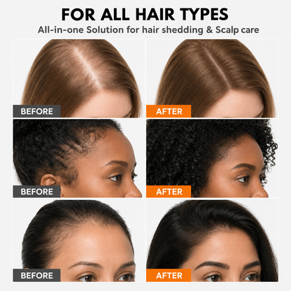 Hair Density Serum for Fuller, Thicker Hair | Korean Scalp Treatment with Built-In Brush